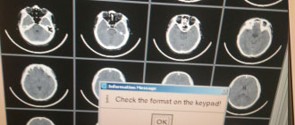 飛利浦BR-16slices CT HOST主機不能打印片子